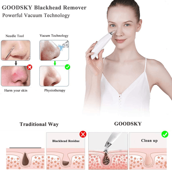 Dubkart Pore Vacuum Facial Blackhead Remover